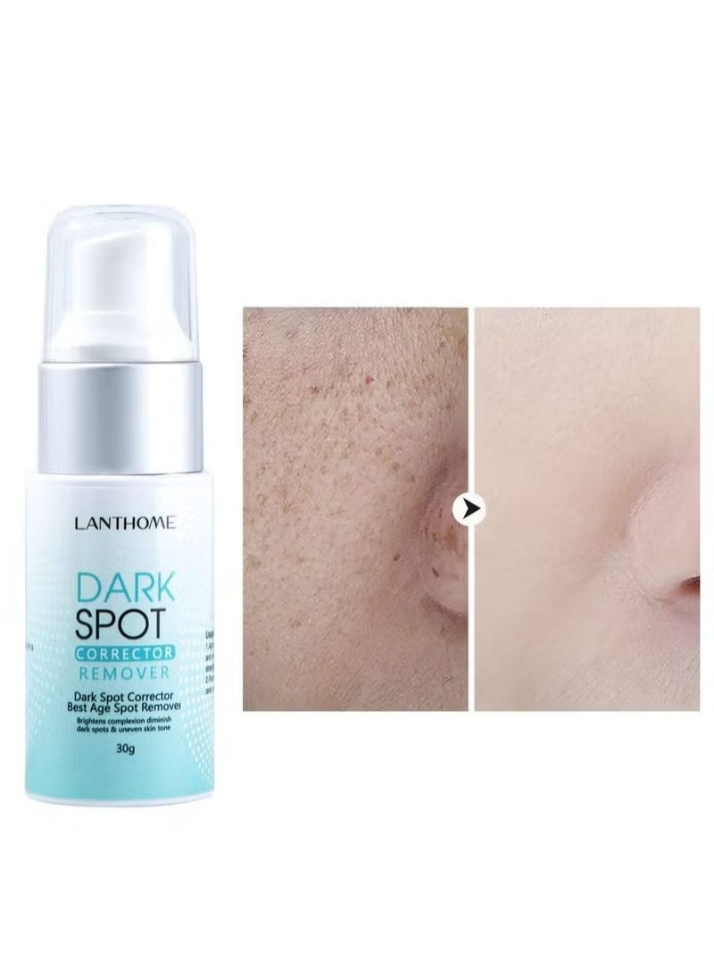 Lanthome - Dark Spot Remover for Face Hyperpigmentation Treatment Dark Spots, Melasma, Freckle, Sun Spots Removal Dark Spot Corrector Cream for Women and Men 30g - Image 1