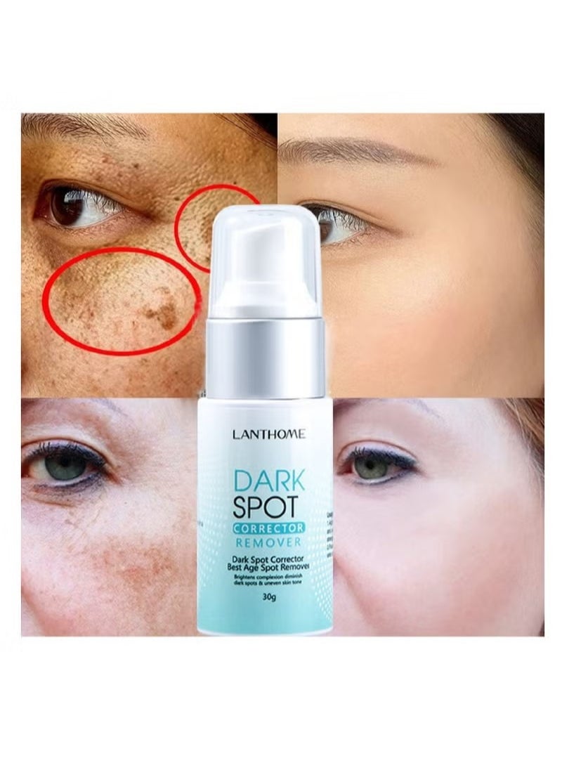 Dark Spot Remover for Face Hyperpigmentation Treatment Dark Spots, Melasma, Freckle, Sun Spots Removal Dark Spot Corrector Cream for Women and Men 30g - pzsku/Z533258CCFB9CF7E9CC19Z/45/_/1719374532/94becb50-5dd0-4603-81c6-fded4beafb29