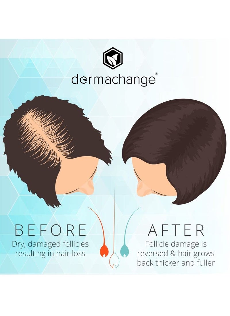 dermachange - Hair Growth Shampoo for Thining and Hair Loss - Sulfate Free for Men and Women - Shinier, Volumizing and Thickening Shampoo for Color Treated Hair with Aloe Vera (16oz) - Image 1