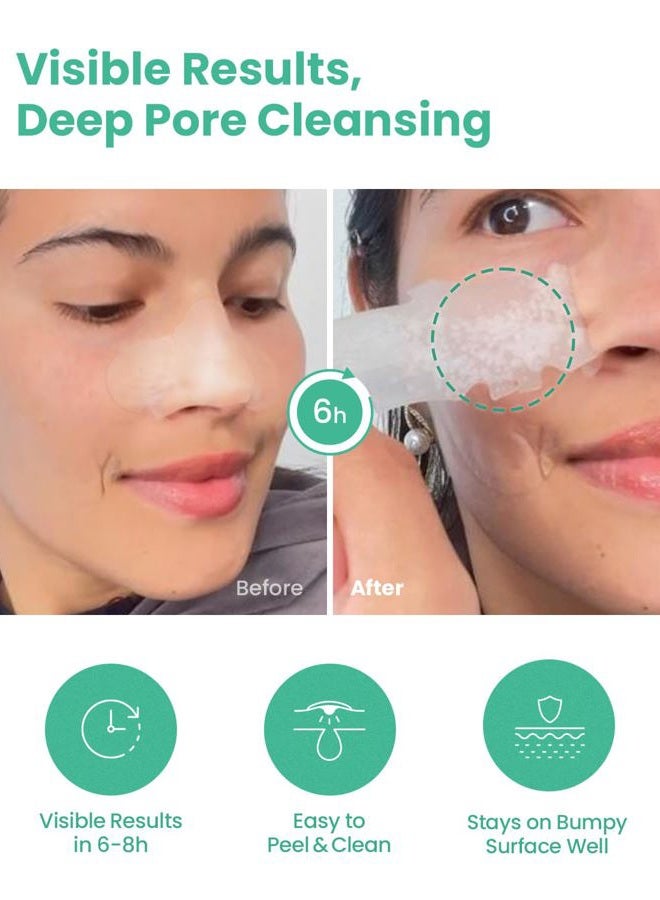 Glam Up Spotless Nose Patch Hydrocolloid Coverage for Nose Pores,Zits and Oil - Strong Waterproof to Absorb Acne Nose Gunk, and Calm Treatment with Tea Tree (12 Patches) - Image 3