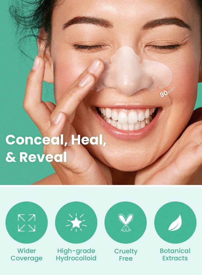 Glam Up Spotless Nose Patch Hydrocolloid Coverage for Nose Pores,Zits and Oil - Strong Waterproof to Absorb Acne Nose Gunk, and Calm Treatment with Tea Tree (12 Patches) - Image 2