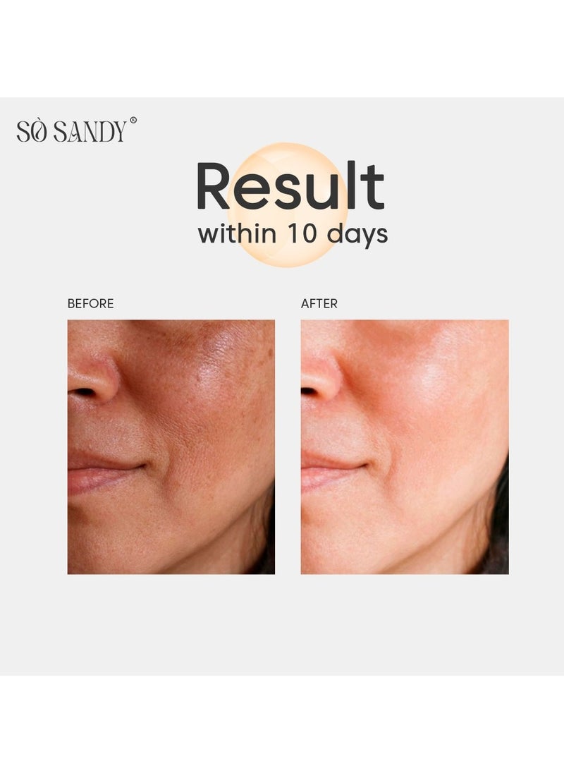 So Sandy - Shine and white Face Serum - Bee Venom Serum - Image 1