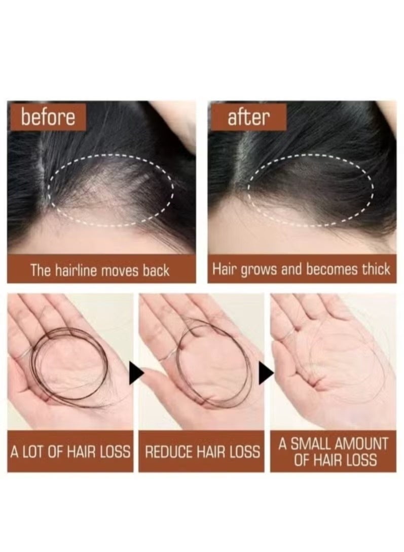 EELHOE Batana Oil for Hair Growth Healthier Thicker Fuller Hair, Batana oil, Batana Oil for Hair Growth, Batana Oil Organic, Batana Oil Organic for Healthy Hair, Batana Oil Hair Mask - Image 3