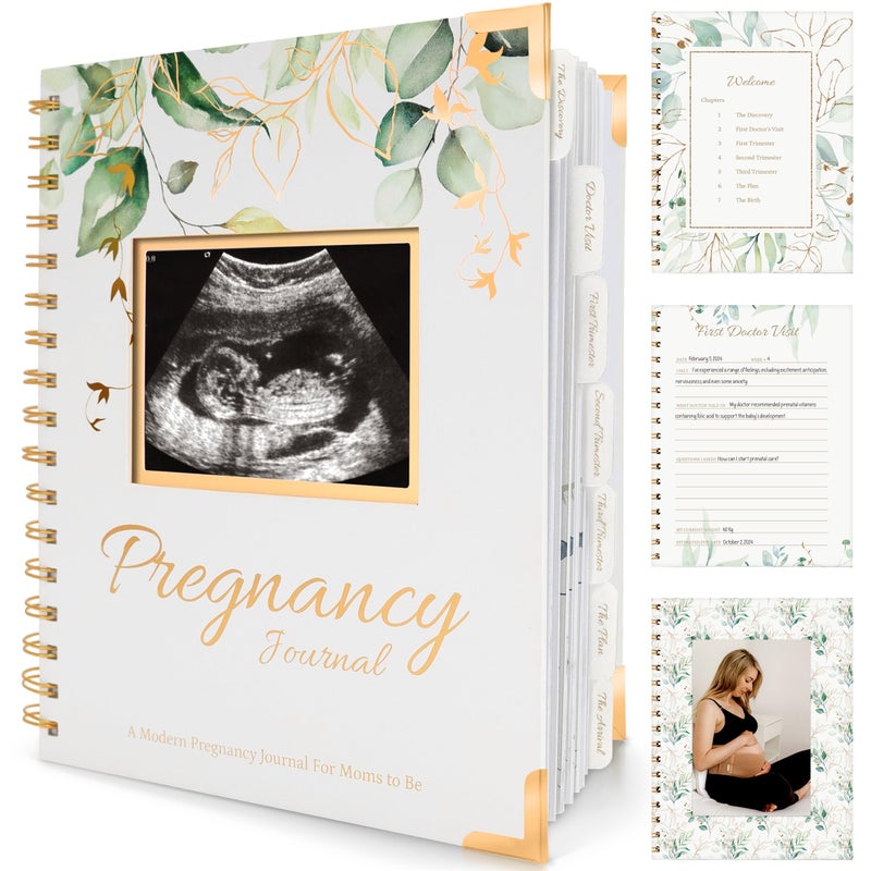 KeaBabies Pregnancy Journal Memory Book - 90 Pages Hardcover Pregnancy Book, Pregnancy Planner, Pregnancy Journals for First Time Moms, Baby Memory Book, Mom Book Diary, Ultrasound Baby Book Memory (Alpine)  - Image 1