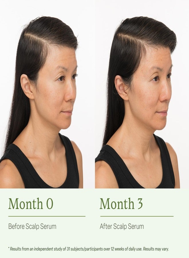 ديفي مجموعة ديفي للعناية بالشعر المرطب، تتضمن شامبو مرطب بالحجم الكامل، وبلسم، وسيروم لفروة الرأس، تنظف الشعر بلطف، وتزيل تراكمات فروة الرأس، وترطبه، وتغذيه، مجموعة من 3 قطع - Image 4