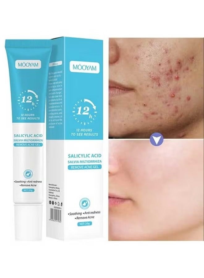 MOOYAM Salicylic Acid Remove Acne Gel 20g, Rapid Action Acne Spot Treatment for Face Closure u0026 Acne Dots, Premium Acne Scar Gel u0026 Pimple Remover - Image 1