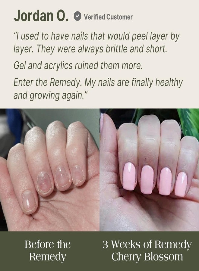 Botanist Nails Botanist Nail Rescue Kit | Strengthening Polish + Growth Serum | Grow and Strengthen Nails Damaged from Acrylics, Dip, and Gel Manicures | Non-Toxic, 84% Plant Based, 21-Free & Vegan (Cherry Blossom) - Image 4