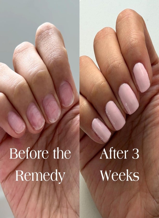 Botanist Nails Botanist Nail Rescue Kit | Strengthening Polish + Growth Serum | Grow and Strengthen Nails Damaged from Acrylics, Dip, and Gel Manicures | Non-Toxic, 84% Plant Based, 21-Free & Vegan (Cherry Blossom) - Image 3