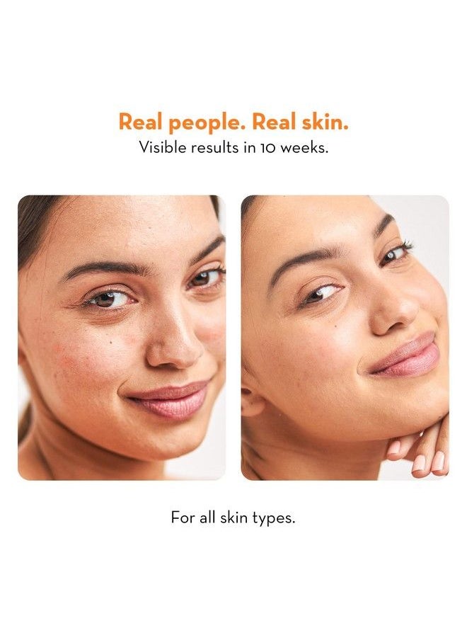 Plush High On Collagen Gentle Face Wash With Niacinamide; Vitamin C Infused Skincare; Natural Beads For Mild Exfoliation; Fights Pigmentation Dark Spots & Skin Aging; For All Skin Types; 100 Ml  - Image 4