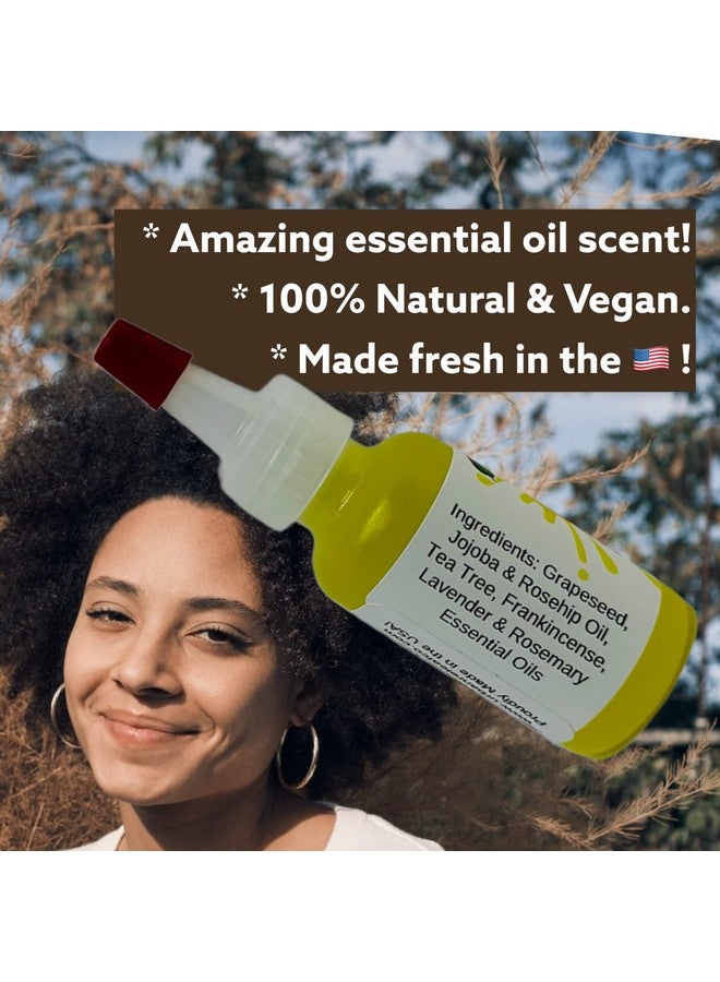 Urban ReLeaf Scaly Skin Spot Treatment Skin Smoothing Repair Oil Natural Relief For Flaky Cracked Dry Body & Face. - Image 5