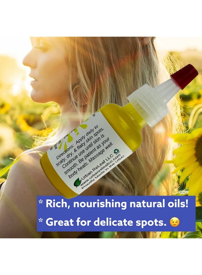 Urban ReLeaf Scaly Skin Spot Treatment Skin Smoothing Repair Oil Natural Relief For Flaky Cracked Dry Body & Face. - Image 3