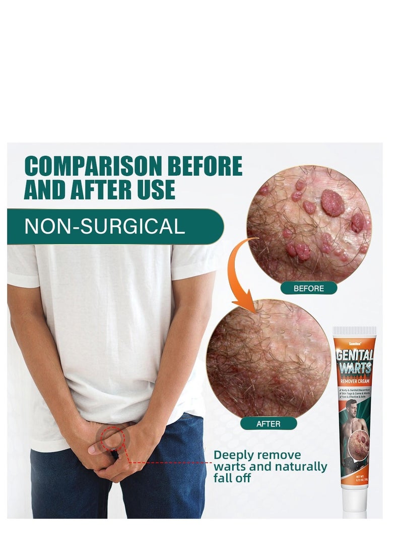 Sumifun Wart Removal Cream, A Gentle Safe Portable Wart Removal Cream with Natural Extracts for All Skin Typesï¼Universal for Both Men and Women Wart Removal .Protecting Health and Beauty 20g - Image 2