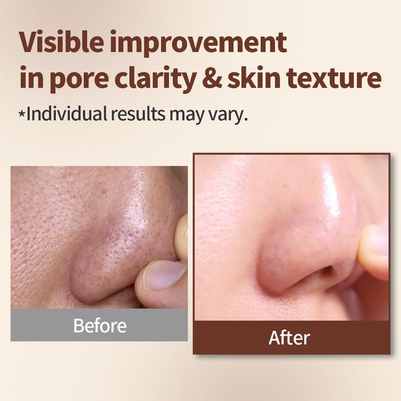 1.618 Volcanic Clay Korean Face Mask Fast-Drying Smooth Mud Mask with Tea Tree Care for Blackheads and Pores Pore Minimizer Skin Care Reducer - Image 3