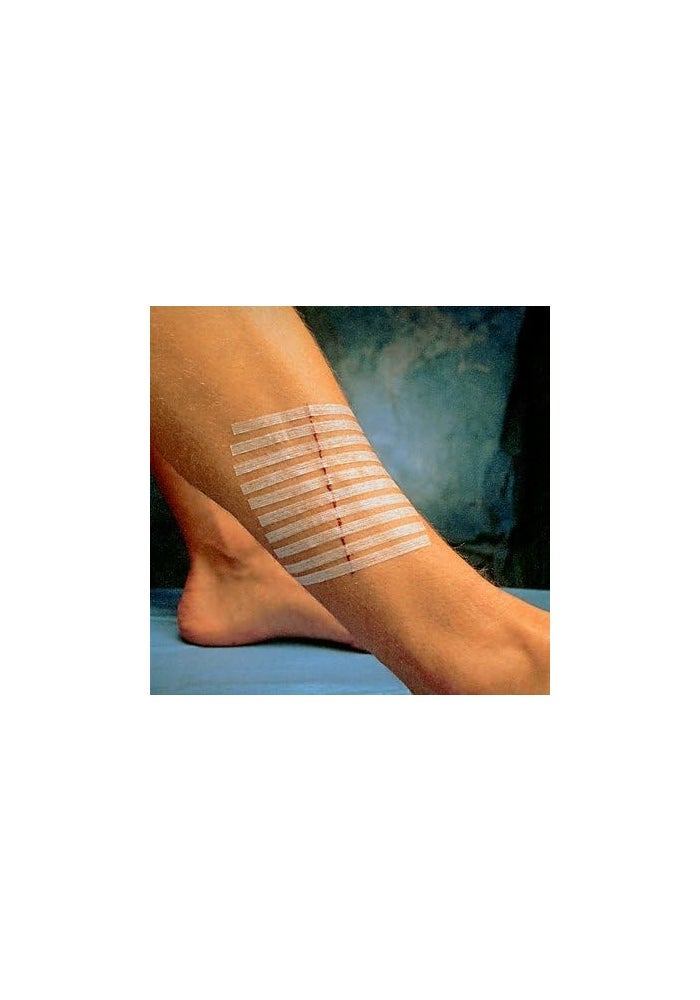 STERI-STRIP 3M Steri-Strip Reinforced Skin Closures, 1/4" x 1 1/2", 6 Packs of 50 Strips - Image 2