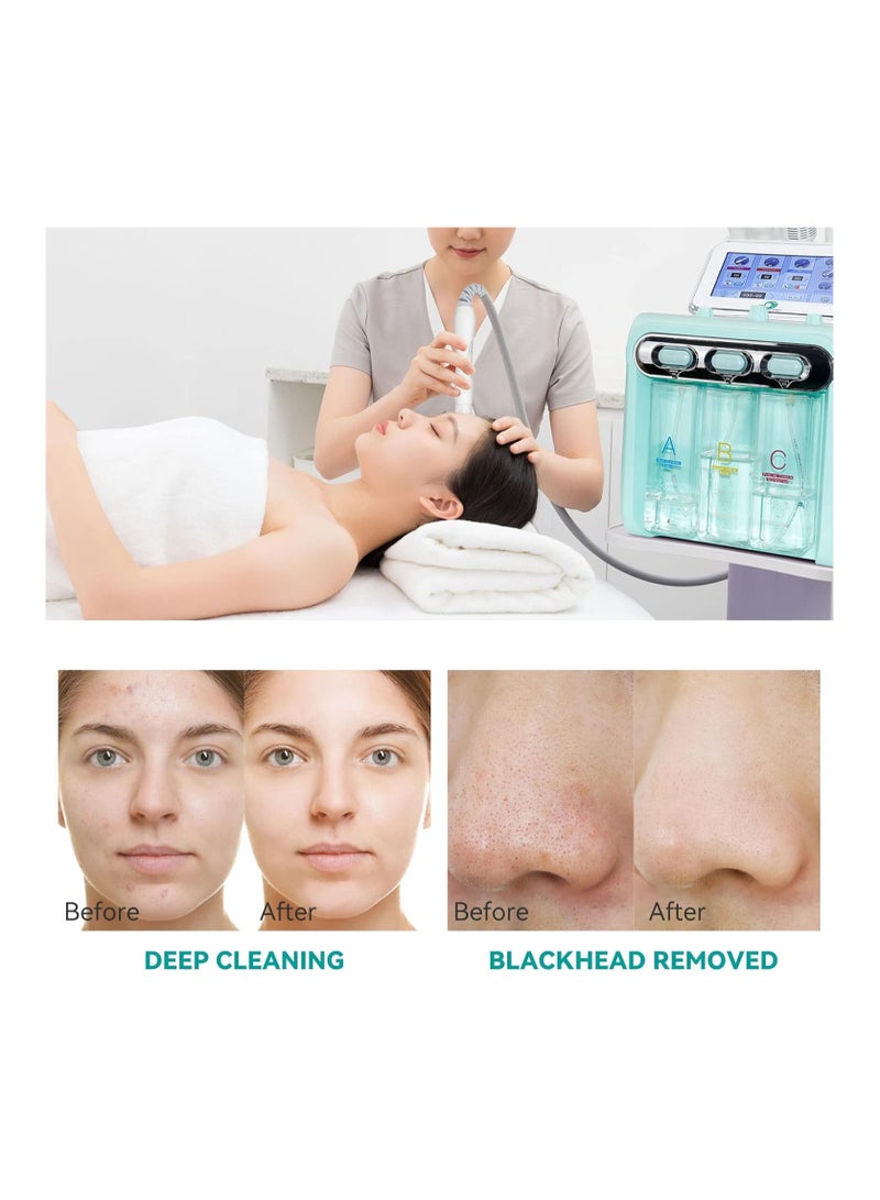 لا بيرلا  تك جهاز تنظيف الوجه بالأوكسجين والهيدروجين، بخاخ هيدرا فيشال 7 في 1 لتجديد شباب البشرة بالشفط بتفريغ الهواء وإزالة الرؤوس السوداء وحب الشباب، - Image 3