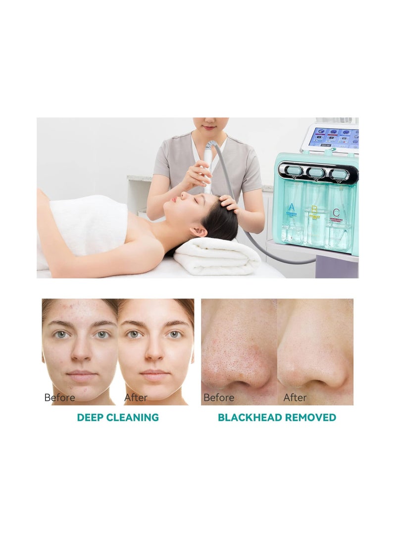 لا بيرلا  تك جهاز تنظيف الوجه بالأوكسجين والهيدروجين، بخاخ هيدرا فيشال 7 في 1 لتجديد شباب البشرة بالشفط بتفريغ الهواء وإزالة الرؤوس السوداء وحب الشباب، - Image 2