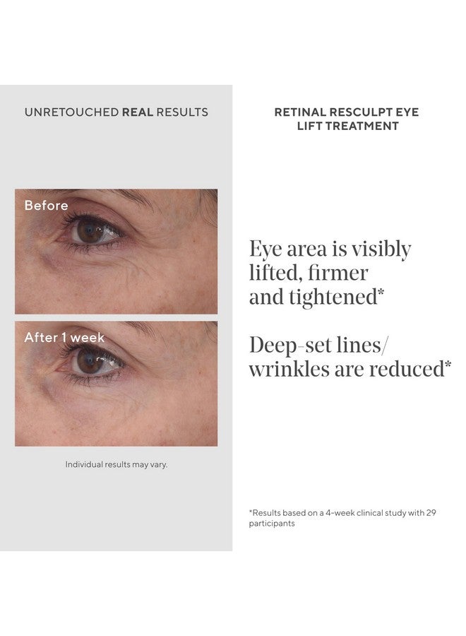 Murad Retinal Resculpt Eye Lift Treatment - Anti-Aging Eye Cream Lifts And Improves Sagging - Encapsulated Vitamin A Eye Care Firms Droopy Eyelids, Reduces Lines And Wrinkles - 0.5 Fl Oz - Image 1