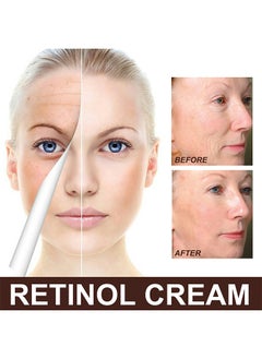 EELHOE Retinol Cream For Face, Retinol Deep Wrinkle Night Cream, Collagen Retinol Hyaluronic Acid Cream, Retinol Cream Moisture Anti-Aging, Retinol Anti Aging Wrinkle Removal Skin Firming Cream 30G  - Image 5