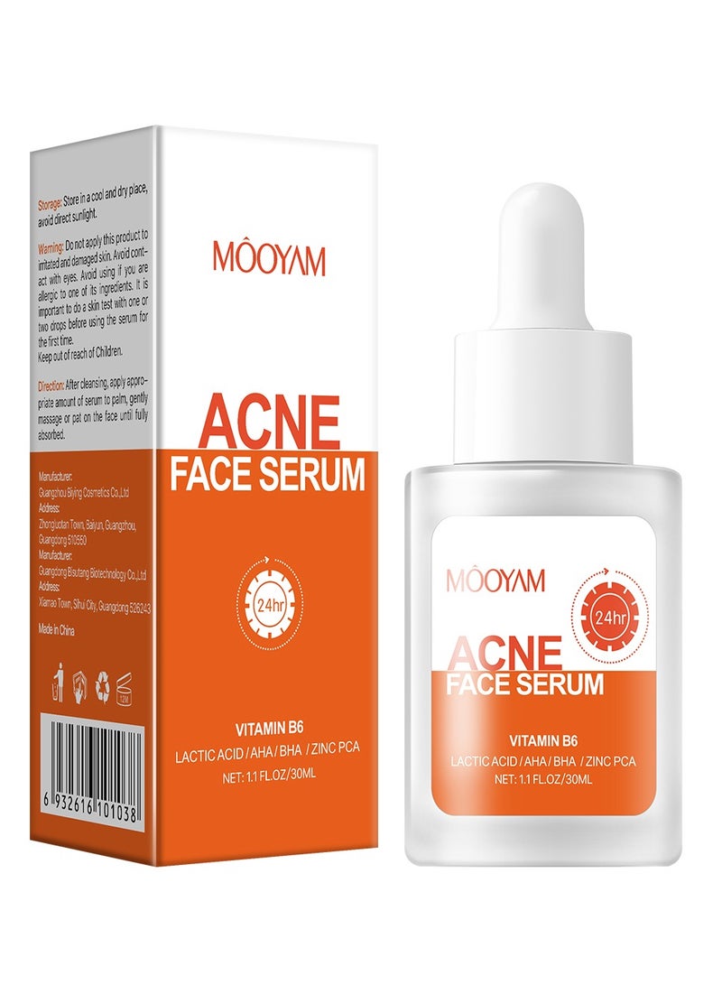 MOOYAM Salicylic Acid Face Serum 30ml - Skin Clearing Treatment for Acne, Blackheads & Pores - Oil Control & Exfoliating Serum for Clear, Smooth Skin  - Image 1
