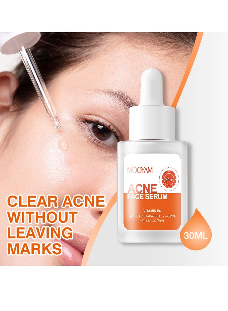 MOOYAM Salicylic Acid Face Serum 30ml - Skin Clearing Treatment for Acne, Blackheads & Pores - Oil Control & Exfoliating Serum for Clear, Smooth Skin  - Image 3