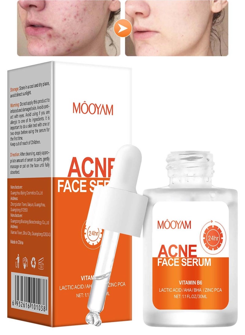 MOOYAM Salicylic Acid Face Serum 30ml - Skin Clearing Treatment for Acne, Blackheads & Pores - Oil Control & Exfoliating Serum for Clear, Smooth Skin - Image 1