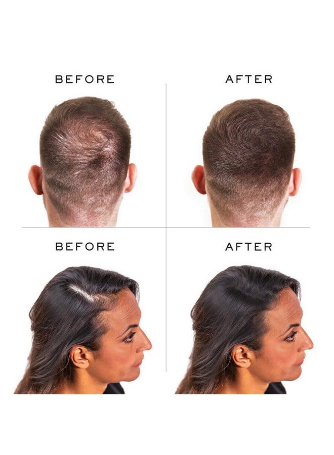 Nanogen Keratin Hair Fibers 30Grams Black - Image 5