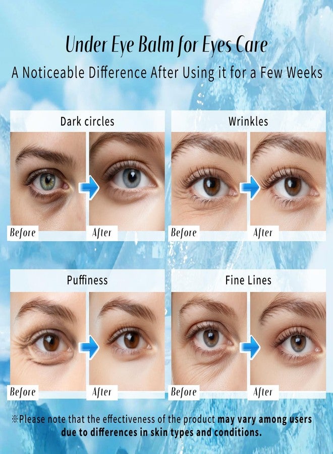 dewyhour Eye Balm for Dark Circles: Cooling Eye Cream Under Eye Treatment, Cool Eye Stick Reduce Wrinkle & Puffiness, Hydrating Balm for Eye Bags Skin Care - Image 2