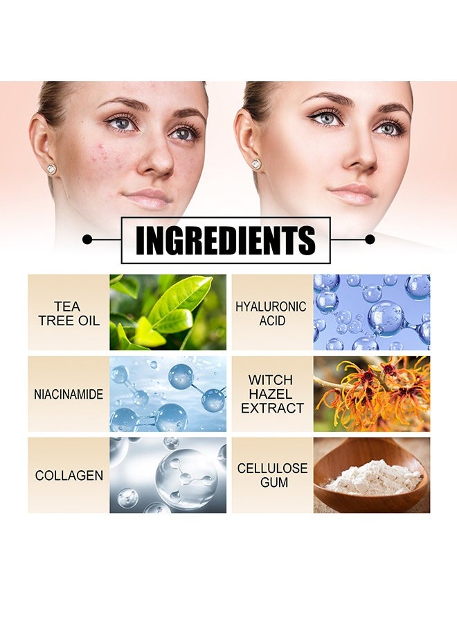 West&Month 60Pcs Acne Patch,Hydrocolloid Acne Patches for Covering Zits and Blemishes, Cute Spot Stickers for Skin Care  - Image 3
