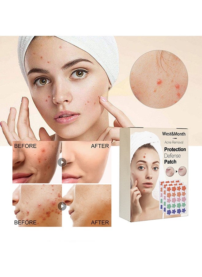 60Pcs Acne Patch,Hydrocolloid Acne Patches for Covering Zits and Blemishes, Cute Spot Stickers for Skin Care - pzsku/Z53C001E3790154716BB7Z/45/_/1716972243/c717232d-12d7-433e-90b8-6ef1b9455b62