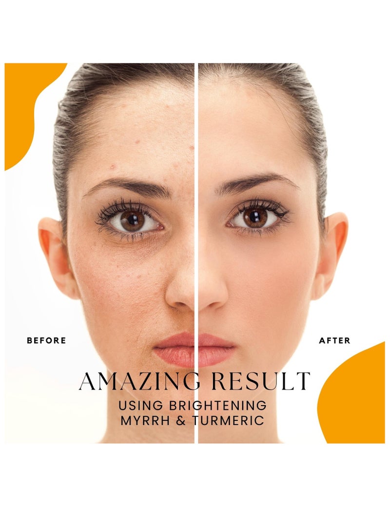 OGAILI Al Myrrh and Turmeric powder Natural Herbal skin Cleanser - Holistic Skin Transformation & Youthful Radiance & Even Skin Tone & Cruelty-Free and Chemical-Free 100G - Image 5