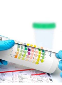 cobas 2 Pack of Combur 10 urine test strips for disease detection 100 pieces  - Image 2