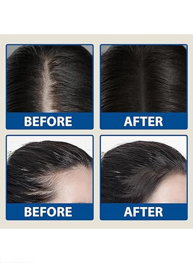 Be Bodywise Hair Growth Serum Roll On, with 3%Rosemary、3%Redensyl 、2% Anagain and 2% Aminexil， Thicker & Stronger Hair，Prevents Hairfall & Stimulates Hair Follicles For All Hair Types 25 ml*2 - Image 4