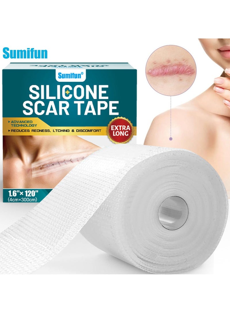 سوميفون رقعة إصلاح الجروح، رقعة إزالة الندبات الجراحية، رقعة العناية بندبات الصدمات الرياضية (4*300 سم) - Image 1