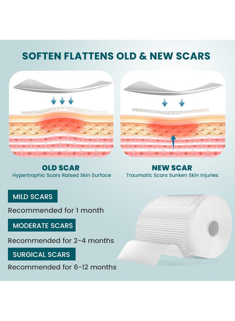 سوميفون رقعة إصلاح الجروح، رقعة إزالة الندبات الجراحية، رقعة العناية بندبات الصدمات الرياضية (4*300 سم) - Image 3