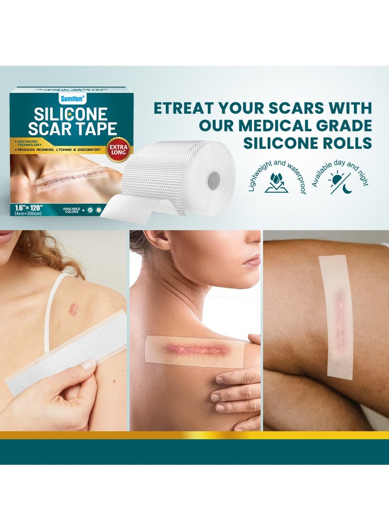 سوميفون رقعة إصلاح الجروح، رقعة إزالة الندبات الجراحية، رقعة العناية بندبات الصدمات الرياضية (4*300 سم) - Image 4