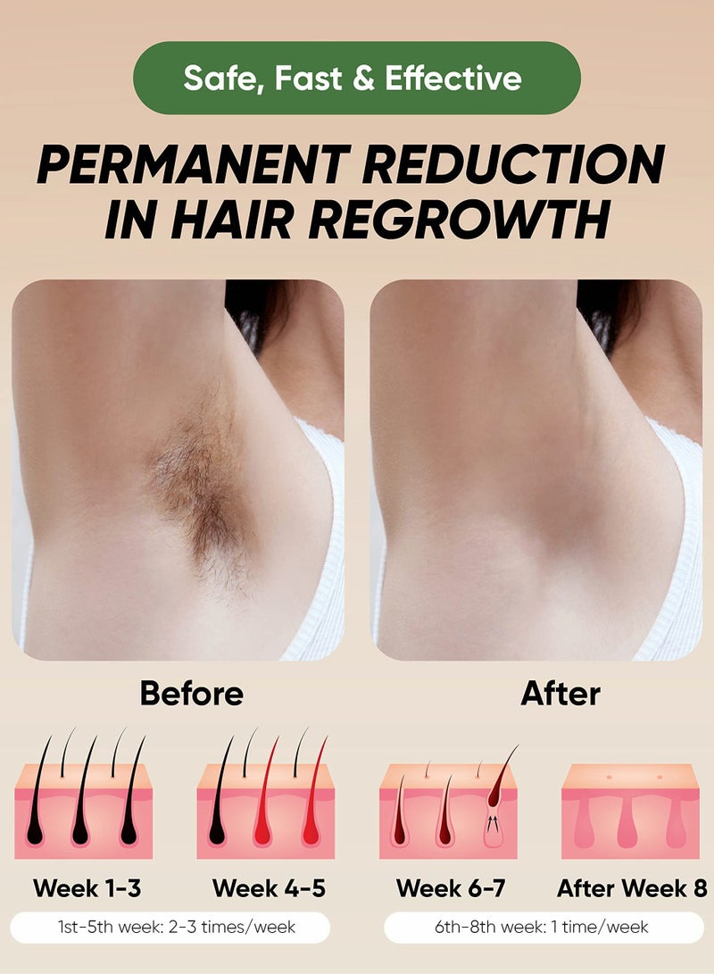 At-Home IPL Hair Removal Device for Men and Women - Safe and Effective Hair Removal Solution  - Image 5