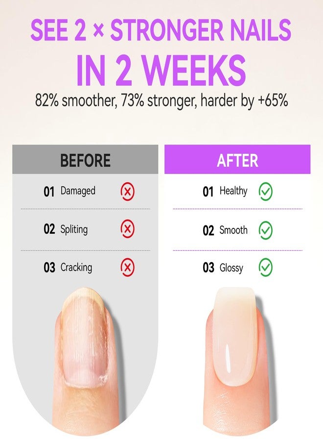 Gelike EC 2-in-1 Nail Rescue Kit: Apricot Nail Nail Growth Treatment & Pineapple Cuticle Oil (15ml) - Tropical Scented Nail Care - Strengthens & Brightens - Travel-Friendly Mini Size - Image 3