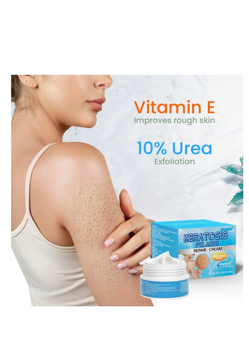 سوميفون كريم إصلاح التقرن الشعري، كريم فيتامين E، اليوريا لإزالة خلايا الجلد الميتة 30 جرام - Image 2