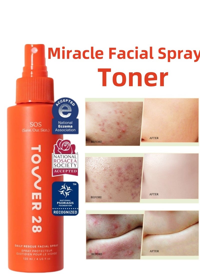 Tower 28 SOS Daily Rescue Facial Spray - The Miracle pH - Balancing Toner! Hypochlorous Acid Formula for Ultra - Sensitive Skin, 4 Fl Oz - Image 1