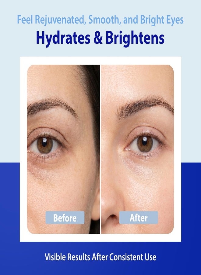 Dr. Denese RetinMax Retinol Eye Cream 0.5oz – Hydrating & Smoothing Under Eye Care with Retinol, Peptides & Vitamin C – Lightweight Formula for Smoother Looking Skin – Suitable for All Skin Types - Image 3