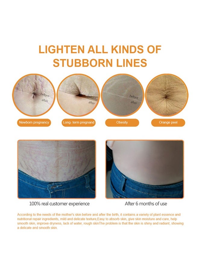 سنملبم غسول تدليك علامات التمدد ، تركيبة مستخلص الجلسرين الغذائية النباتية الطبيعية ، الوقاية من علامات التمدد ، مرطب الجسم للندبات القديمة ، زبدة البطن لعلامات التمدد لشد البشرة مرطب 30 مل - Image 3