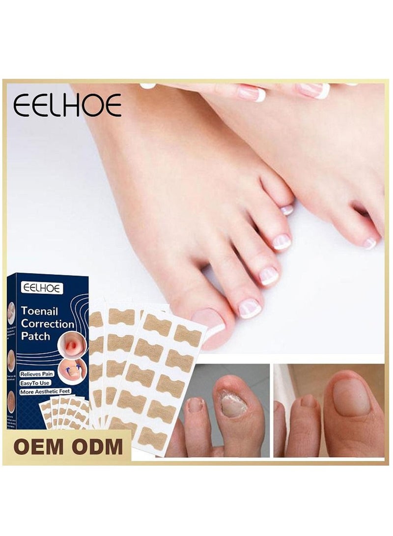 EELHOE 50 قطعة من ملصقات تصحيح أظافر القدم، شرائط تصحيح أظافر القدم الغارزة، ملصقات دعامة مرنة لأظافر القدم - Image 3