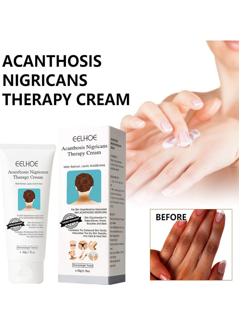 EELHOE Acanthosis Nigricans Therapy Cream, Dark Spot Corrector Cream Whitening Serum, Acanthosis Nigricans Treatment, Dark Spot Removal (1PCS) - Image 4