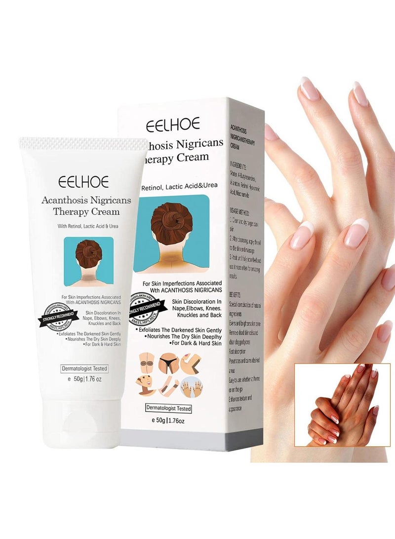 EELHOE Acanthosis Nigricans Therapy Cream, Dark Spot Corrector Cream Whitening Serum, Acanthosis Nigricans Treatment, Dark Spot Removal (1PCS) - Image 1