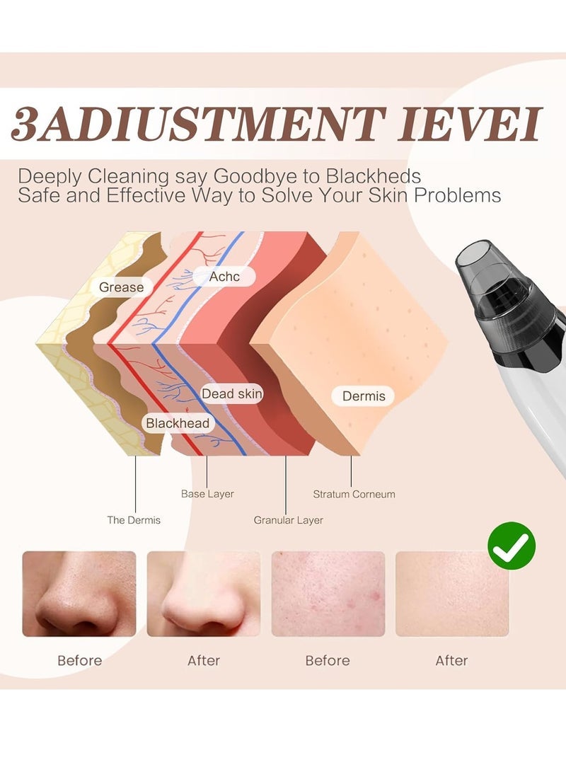 Multifunctional Blackhead Remover Pore Vacuum Heating, Electric Acne Blackhead Remover Tool, 4 Types of Suction Power with LED Display, Rechargeable Acne Remover Tool Kit - Image 2