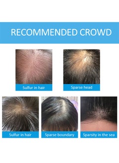 Elaimei ELAIMEI hair fiber powder, hair fiber, thickening and thickening hair, natural hair fiber  - Image 2