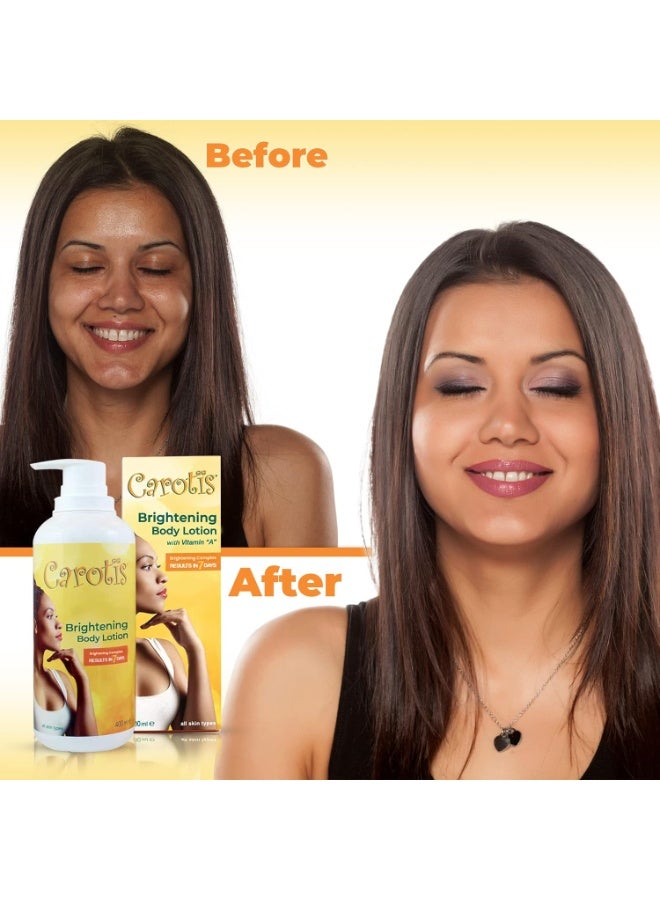 Carotis Lightening Body Lotion with Vitamin A and Alpha-Arbutin - Image 5