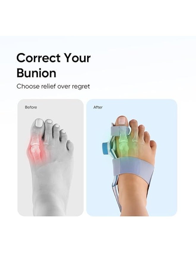 Orthopedic Bunion Corrector Splint - Adjustable Toe Straightener with Pressure Control Knob & Soft Gel Cushion - Pain Relief & Toe Alignment - Image 5