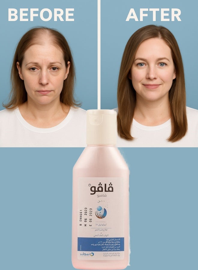 Vavo 2% Shampoo 100ML - Image 2