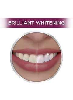 Crest 10-Piece 3D Teeth Whitening Kit - Professional Effects  - Image 3